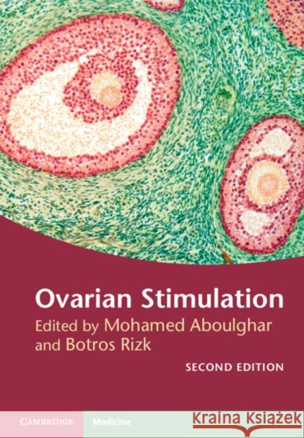 Ovarian Stimulation Mohamed Aboulghar Botros Rizk 9781107135970 Cambridge University Press