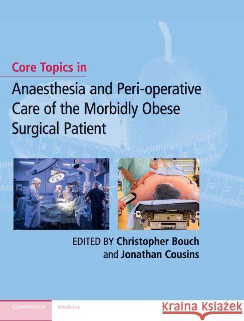 Core Topics in Anaesthesia and Peri-Operative Care of the Morbidly Obese Surgical Patient Bouch, Christopher 9781107163287 Cambridge University Press