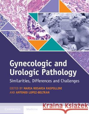 Gynecologic and Urologic Pathology: Similarities, Differences and Challenges [With eBook] Raspollini, Maria Rosaria 9781107170452