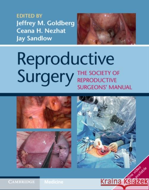 Reproductive Surgery: The Society of Reproductive Surgeons' Manual Jeffrey Goldberg Ceana Nezhat Jay Sandlow 9781107193963 Cambridge University Press
