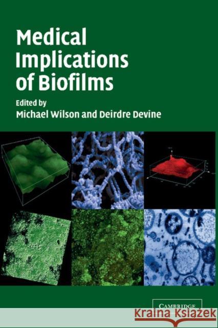 Medical Implications of Biofilms Michael Wilson Deirdre Devine 9781107403451