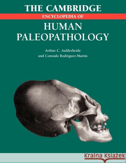 The Cambridge Encyclopedia of Human Paleopathology Arthur C. Aufderheide Conrado Rodriguez-Martin 9781107403772 Cambridge University Press