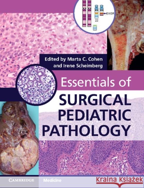 Essentials of Surgical Pediatric Pathology with DVD-ROM Marta C. Cohen Irene Scheimberg 9781107430808