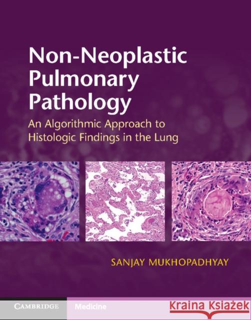 Non-Neoplastic Pulmonary Pathology with Online Resource: An Algorithmic Approach to Histologic Findings in the Lung Sanjay Mukhopadhyay 9781107443501 CAMBRIDGE UNIVERSITY PRESS