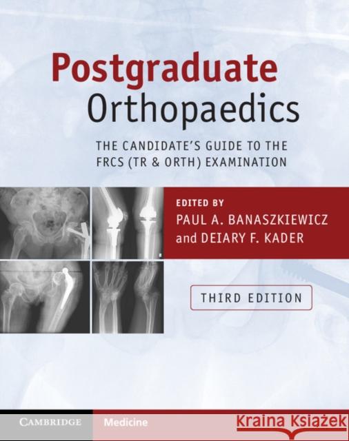 Postgraduate Orthopaedics: The Candidate's Guide to the Frcs (Tr & Orth) Examination Banaszkiewicz, Paul A. 9781107451643 Cambridge University Press