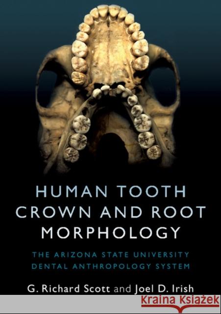 Human Tooth Crown and Root Morphology: The Arizona State University Dental Anthropology System Scott, G. Richard 9781107480735 Cambridge University Press