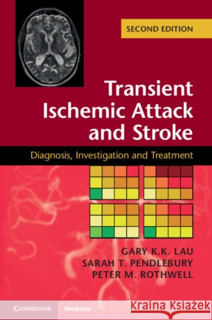Transient Ischemic Attack and Stroke Lau, Gary K. K. 9781107485358 Cambridge University Press