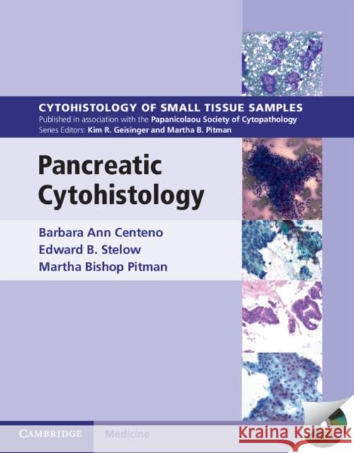Pancreatic Cytohistology Barbara A. Centeno Edward Stelow Martha Bishop Pitman 9781107518308 Cambridge University Press