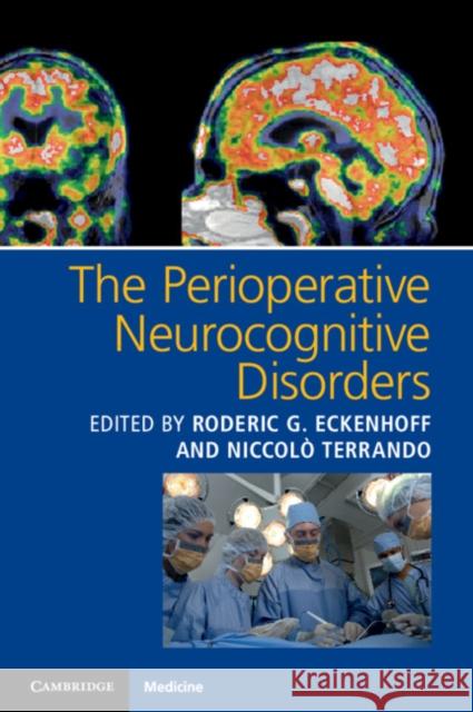 The Perioperative Neurocognitive Disorders Roderic G. Eckenhoff Niccolo Terrando 9781107559202 Cambridge University Press