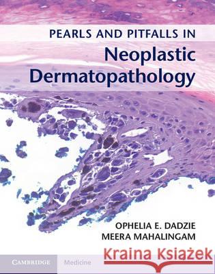 Pearls and Pitfalls in Neoplastic Dermatopathology with Online Access Ophelia E. Dadzie Meera Mahalingam Ophelia E. Dadzie 9781107584587