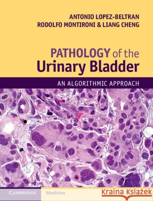 Pathology of the Urinary Bladder: An Algorithmic Approach Antonio Lopez-Beltran Rodolfo Montironi Liang Cheng 9781107593374