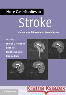 More Case Studies in Stroke: Common and Uncommon Presentations Hennerici, Michael G. 9781107610033
