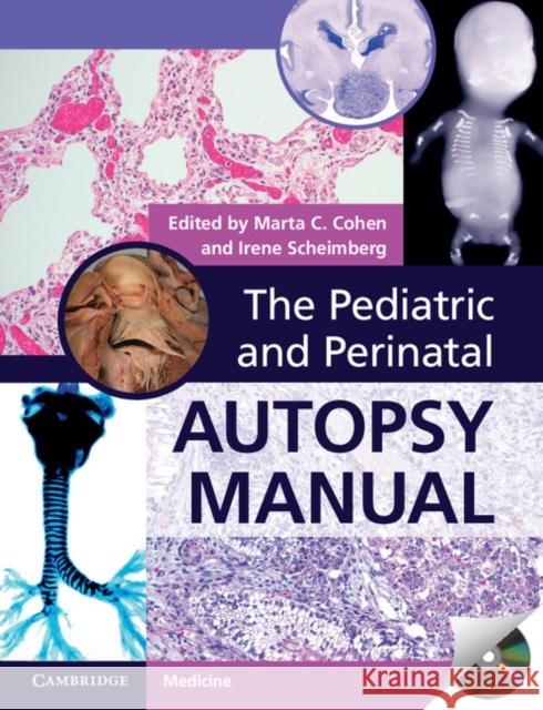 The Pediatric and Perinatal Autopsy Manual with DVD-ROM Marta C. Cohen Irene Scheimberg  9781107646070