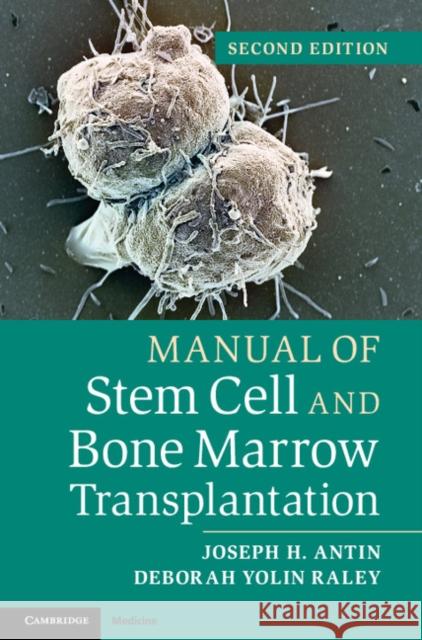 Manual of Stem Cell and Bone Marrow Transplantation Joseph H Antin 9781107661547 CAMBRIDGE UNIVERSITY PRESS