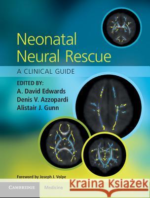 Neonatal Neural Rescue : A Clinical Guide A David Edwards 9781107681606 CAMBRIDGE UNIVERSITY PRESS