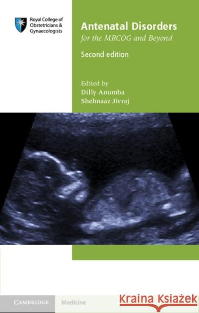 Antenatal Disorders for the MRCOG and Beyond Dilly Anumba 9781107684928