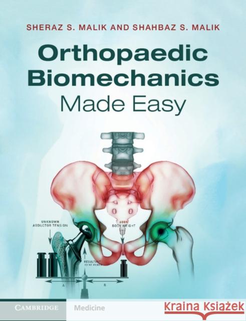Orthopaedic Biomechanics Made Easy Shahbaz S Malik & Sheraz S Malik 9781107685468 CAMBRIDGE UNIVERSITY PRESS