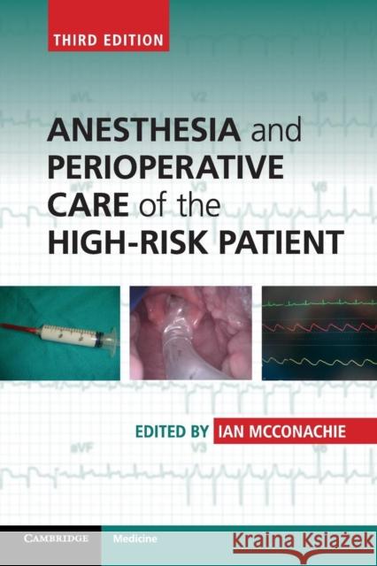 Anesthesia and Perioperative Care of the High-Risk Patient Ian McConachie 9781107690578 CAMBRIDGE UNIVERSITY PRESS