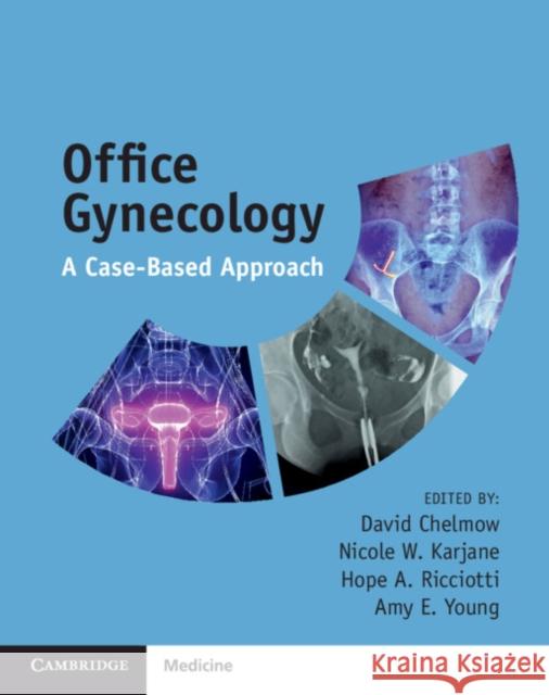 Office Gynecology: A Case-Based Approach David Chelmow Nicole Karjane Hope Ricciotti 9781108400220