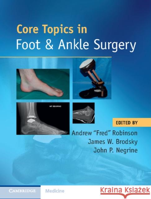 Core Topics in Foot and Ankle Surgery Andrew Fred Robinson James W. Brodsky John P. Negrine 9781108418935