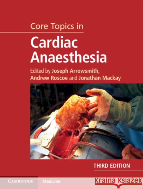 Core Topics in Cardiac Anaesthesia Joseph Arrowsmith Andrew Roscoe Jonathan MacKay 9781108419383