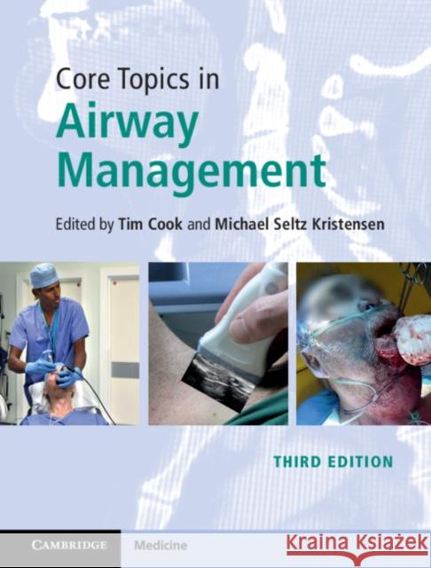Core Topics in Airway Management Tim Cook Michael Kristensen 9781108419536 Cambridge University Press