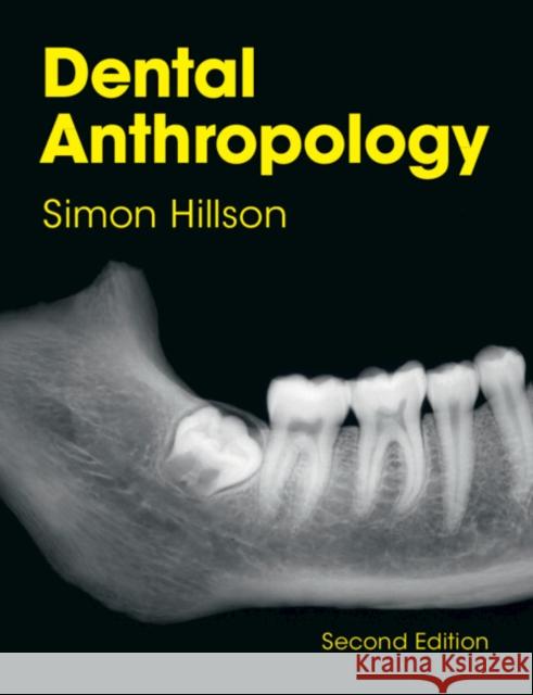 Dental Anthropology Simon (University College London) Hillson 9781108433969 Cambridge University Press