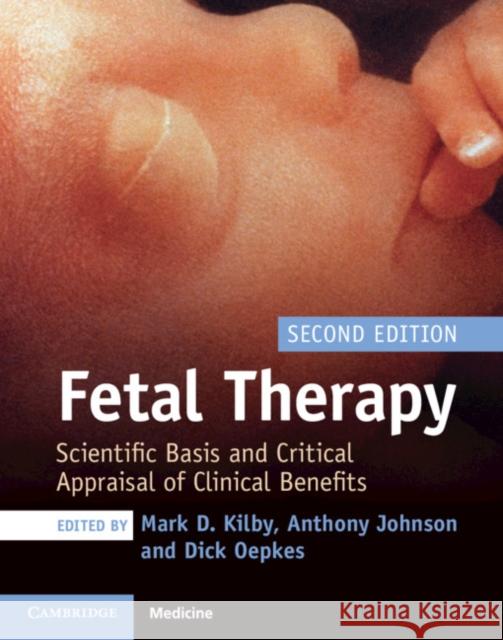Fetal Therapy: Scientific Basis and Critical Appraisal of Clinical Benefits Mark D. Kilby Anthony Johnson Dick Oepkes 9781108474061 Cambridge University Press