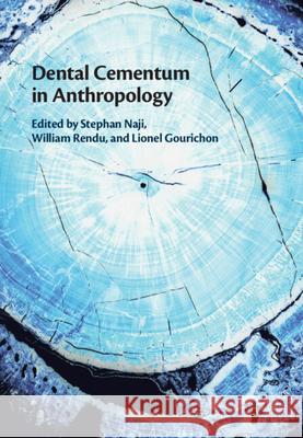 Dental Cementum in Anthropology Stephan Naji (New York University), William Rendu, Lionel Gourichon (Université de Nice, Sophia Antipolis) 9781108477086 Cambridge University Press