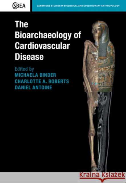 The Bioarchaeology of Cardiovascular Disease Michaela Binder Charlotte A. Roberts Daniel Antoine 9781108480345