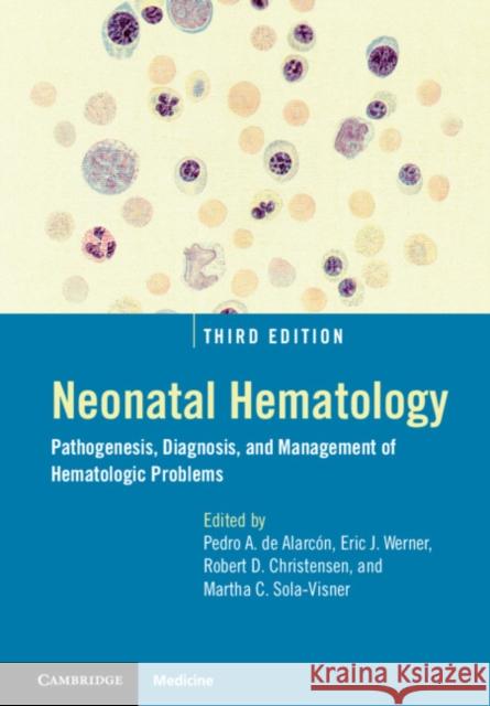 Neonatal Hematology: Pathogenesis, Diagnosis, and Management of Hematologic Problems Pedro A. de Alarcón, Eric J. Werner, Robert D. Christensen (University of Utah), Martha C. Sola-Visner (Harvard Universi 9781108488983