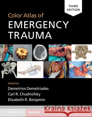Color Atlas of Emergency Trauma Demetrios Demetriades, Carl R. Chudnofsky, Elizabeth R. Benjamin 9781108489348