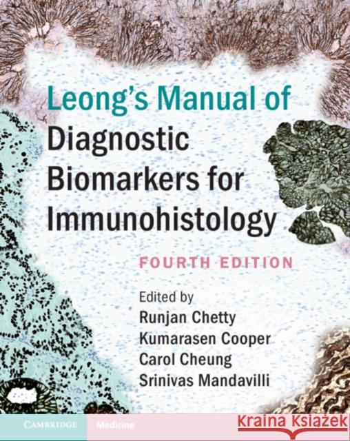 Leong's Manual of Diagnostic Biomarkers for Immunohistology Runjan Chetty (University of Toronto), Kumarasen Cooper (University of Pennsylvania), Carol Cheung (University of Toront 9781108491570 Cambridge University Press