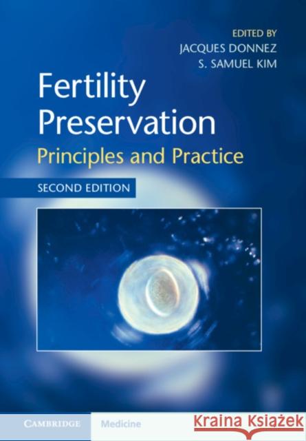 Fertility Preservation: Principles and Practice Jacques Donnez S. Samuel Kim  9781108494595 Cambridge University Press