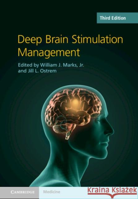 Deep Brain Stimulation Management William J. Marks Jill L. Ostrem 9781108494991