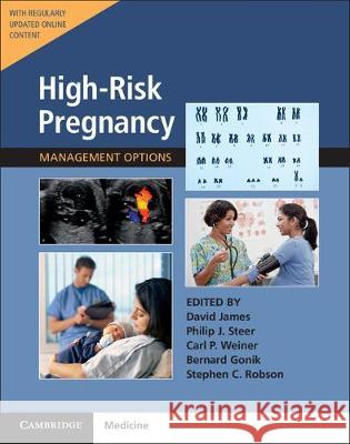 High-Risk Pregnancy with Online Resource: Management Options James, David 9781108591706