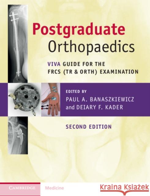 Postgraduate Orthopaedics: Viva Guide for the Frcs (Tr & Orth) Examination Paul A. Banaszkiewicz Deiary F. Kader 9781108722155 Cambridge University Press