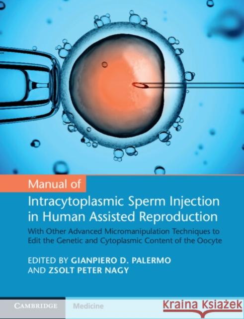 Manual of Intracytoplasmic Sperm Injection in Human Assisted Reproduction: With Other Advanced Micromanipulation Techniques to Edit the Genetic and Cytoplasmic Content of the Oocyte Gianpiero D. Palermo, Zsolt Peter Nagy 9781108743839 Cambridge University Press