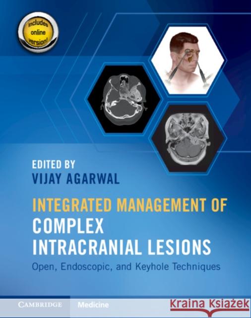 Integrated Management of Complex Intracranial Lesions Hardback Set and Static Online Product: Open, Endoscopic, and Keyhole Techniques Vijay Agarwal 9781108782838