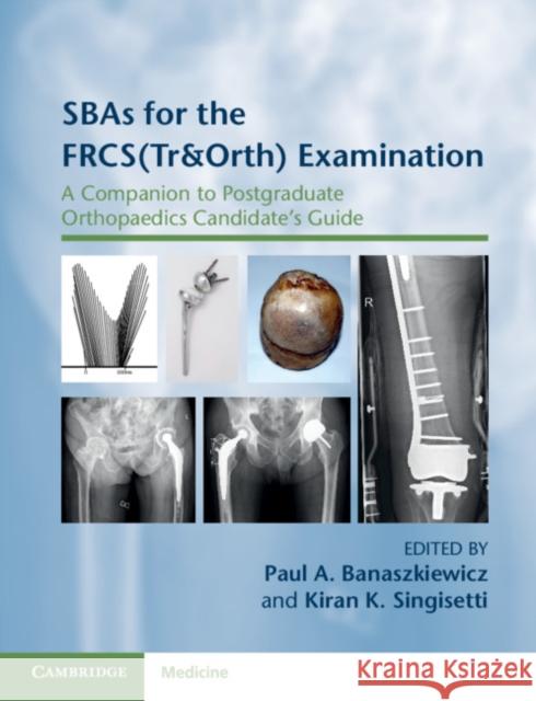 Sbas for the Frcs(tr&orth) Examination: A Companion to Postgraduate Orthopaedics Candidate's Guide Paul A. Banaszkiewicz Kiran K. Singisetti 9781108789974 Cambridge University Press
