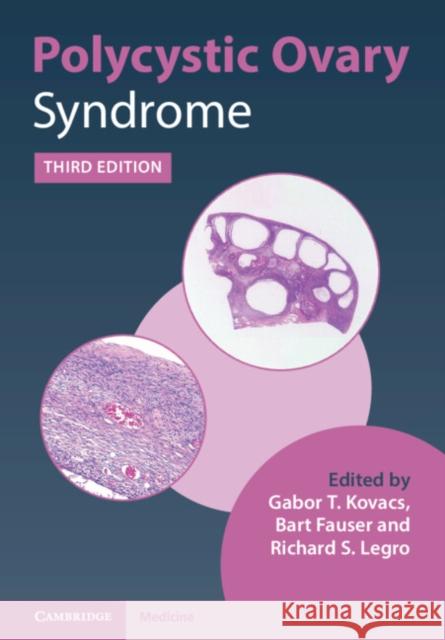Polycystic Ovary Syndrome Gabor T. Kovacs, Bart Fauser, Richard S. Legro 9781108839334 Cambridge University Press