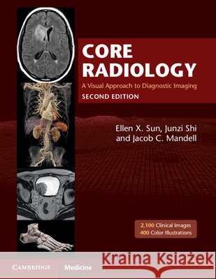 Core Radiology: A Visual Approach to Diagnostic Imaging Ellen X. Sun Junzi Shi Jacob C. Mandell 9781108965910