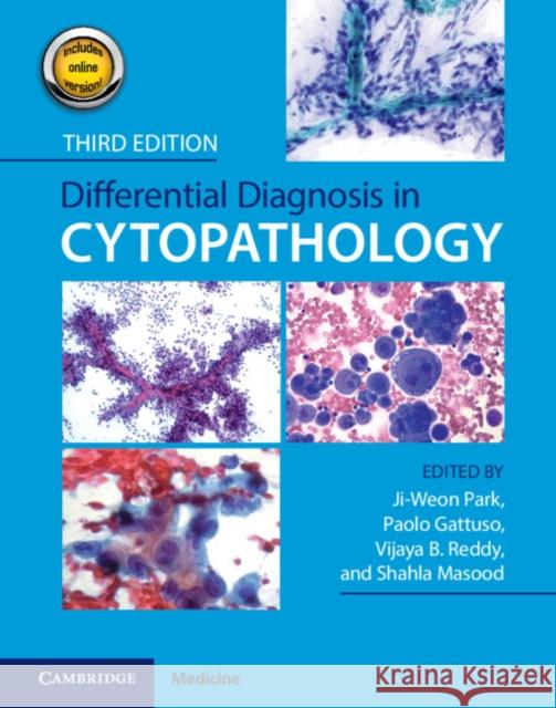 Differential Diagnosis in Cytopathology Ji-Weon Park Paolo Gattuso Vijaya Reddy 9781108975643 Cambridge University Press