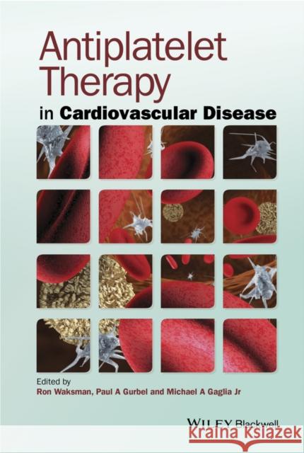 Antiplatelet Therapy in Cardiovascular Disease Waksman, Ron 9781118275757