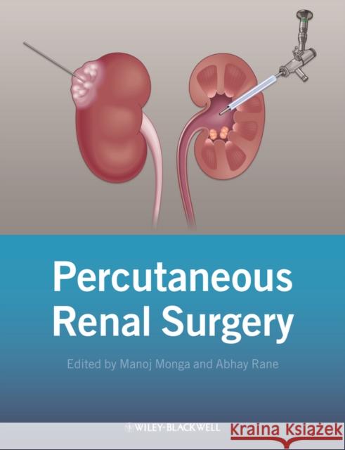 Percutaneous Renal Surgery Monga, Manoj; Rane, Abhay 9781118278734 John Wiley & Sons