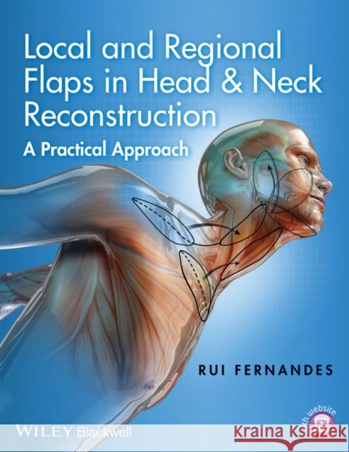 Local and Regional Flaps in Head and Neck Reconstruction: A Practical Approach Fernandes, Rui 9781118340332 John Wiley & Sons