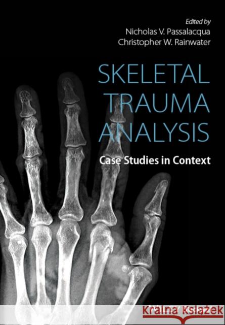 Skeletal Trauma Analysis Rainwater, Christopher W. 9781118384220 John Wiley & Sons