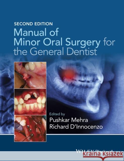 Manual of Minor Oral Surgery for the General Dentist Pushkar Mehra Richard D?innocenzo 9781118432150 Wiley-Blackwell