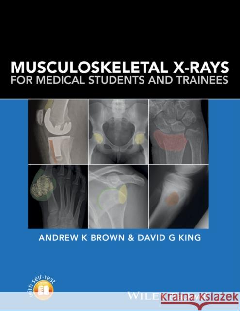 Musculoskeletal X-Rays for Medical Students and Trainees Brown, Andrew K.; King, David 9781118458730