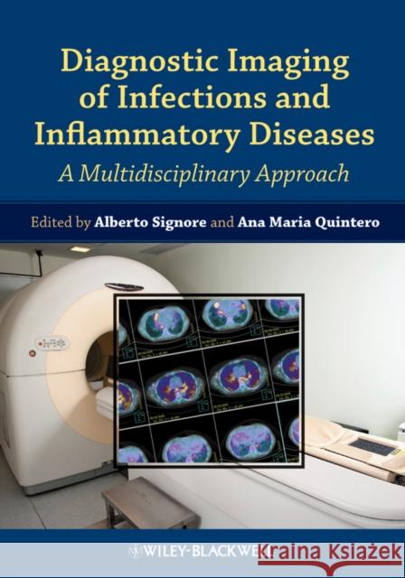 Diagnostic Imaging of Infections and Inflammatory Diseases: A Multidiscplinary Approach Signore, Alberto 9781118484418